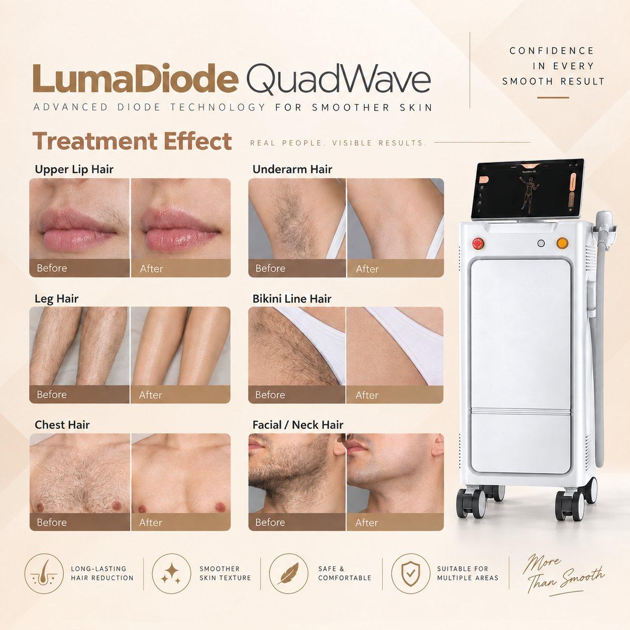 LumaDiode QuadWave illustrative before and after hair removal on upper lip, underarms, legs, bikini line, chest and face